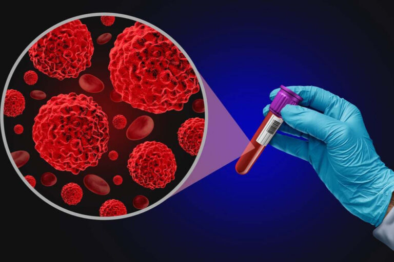 Mieloma múltiple, un cáncer sigiloso