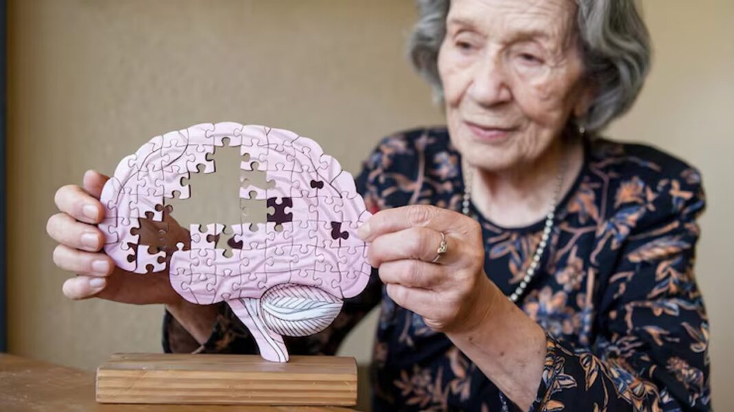 Ilustración sobre el Alzheimer y la prevención