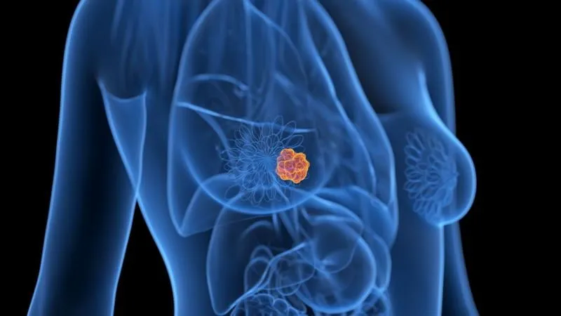Médico especialista brindando una columna sobre mamografía y detección temprana del cáncer de mama
